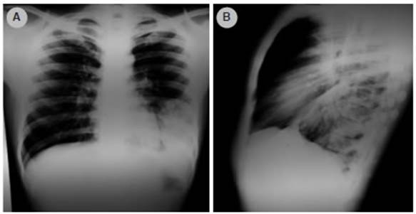RAMR - Volume 23 Number 1 - Epidemiological and Radiological ...